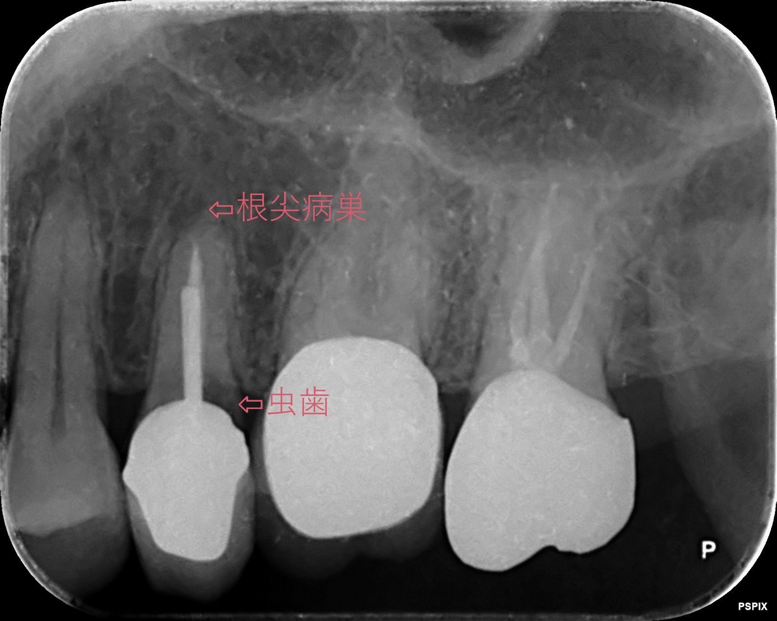 治療前