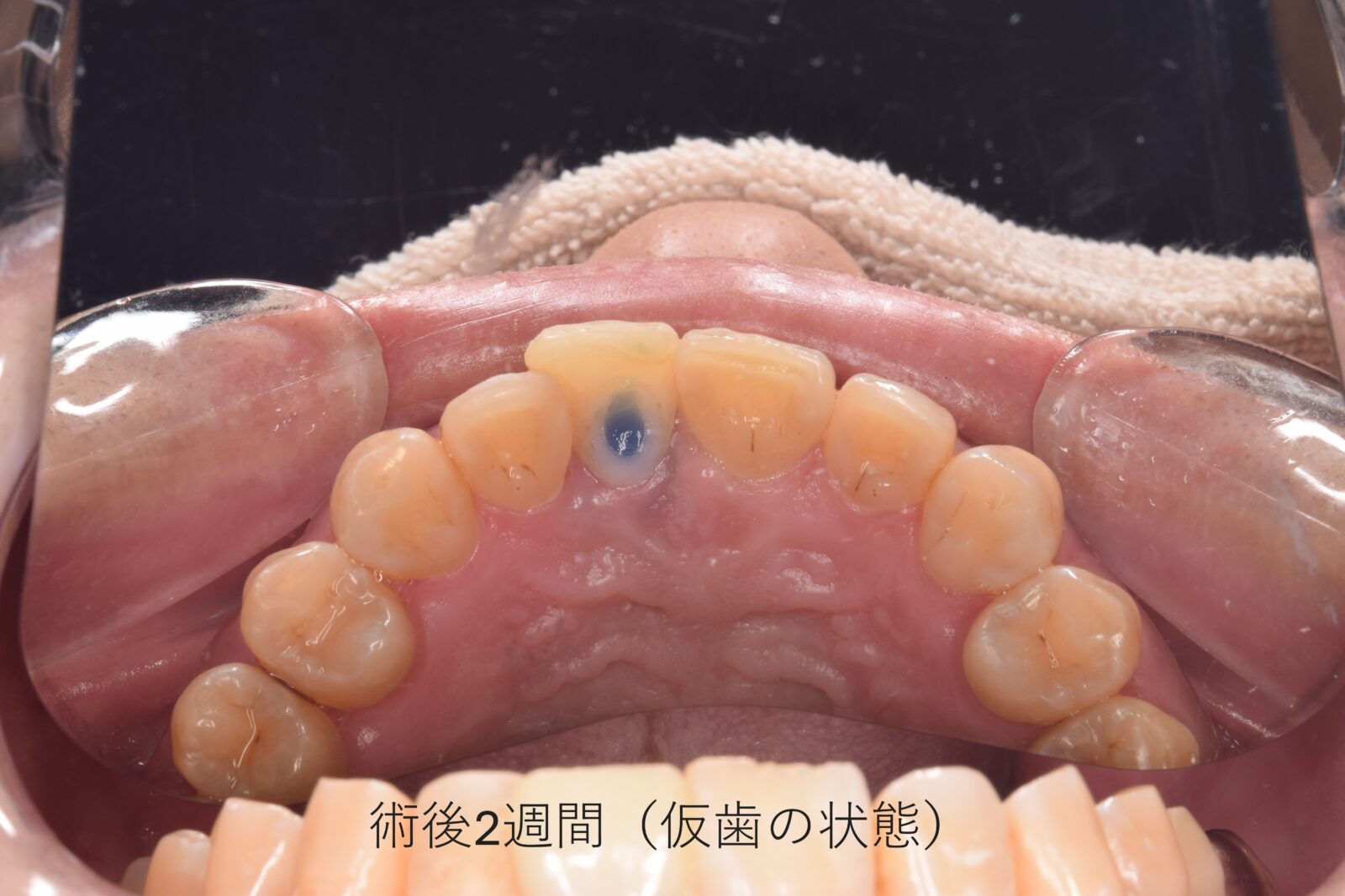 治療前